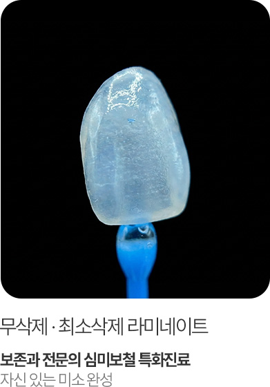 무삭제·최소삭제 라미네이트