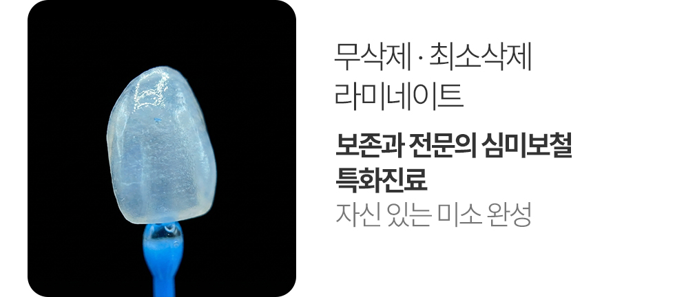 무삭제·최소삭제 라미네이트