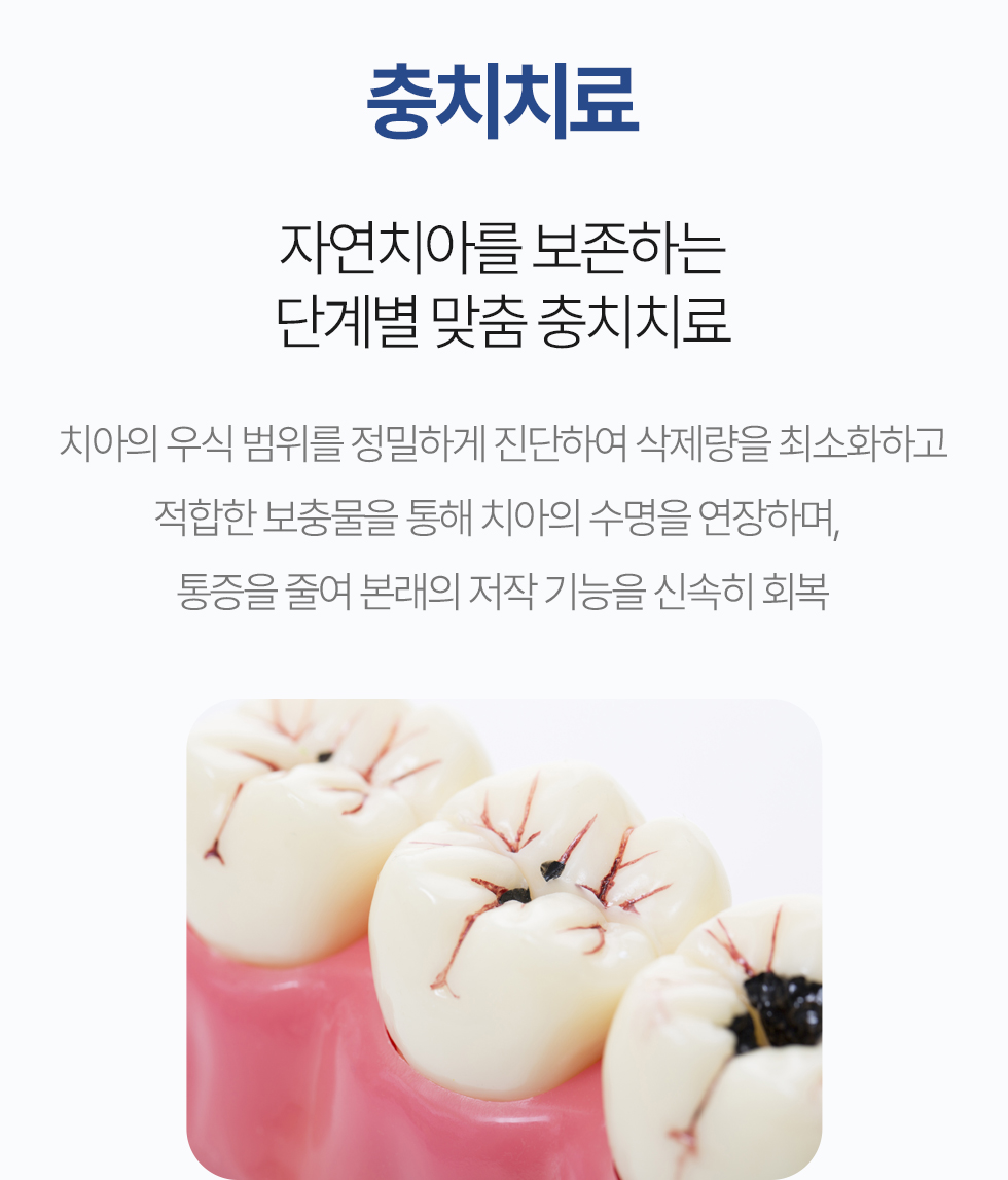 충치치료
