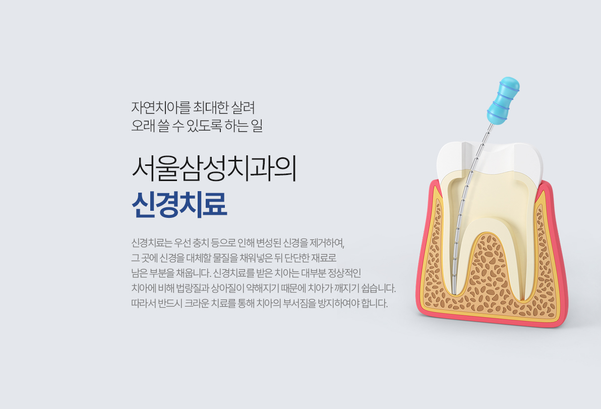 서울삼성치과 신경치료 안내