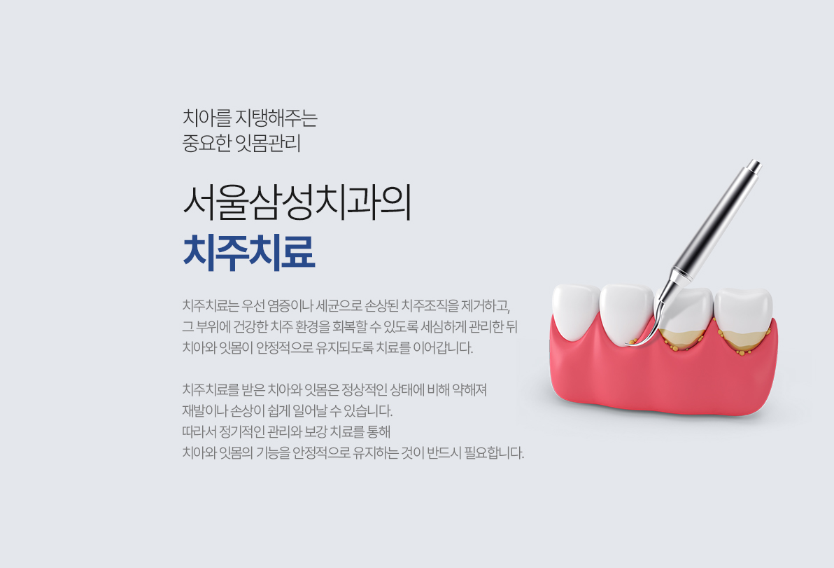 서울삼성치과 치주치료 안내