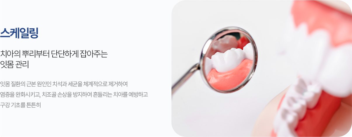 스케일링