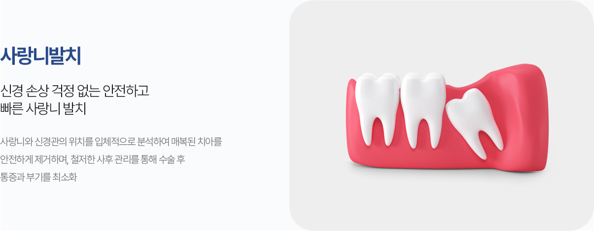 사랑니발치